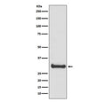 Western blot testing of human fetal brain lysate with Calbindin antibody. Predicted molecular weight: 27-28 kDa.