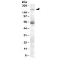 Western blot testing of human skeletal muscle lysate with NOS1 antibody at 0.1ug/ml. Predicted/observed molecular weight: ~161 kDa.