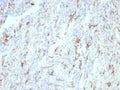 IHC staining of FFPE human tonsil tissue with CD163 antibody (clone rM130/8823). HIER: boil tissue sections in pH 9 10mM Tris with 1mM EDTA for 20 min and allow to cool before testing.