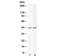 Western blot testing of human 1) A431 and 2) HeLa cell lysate with BMP4 antibody at 0.3ug/ml. Predicted molecular weight: 54 kDa (precursor), 44 kDa (cleaved dimer), 23 kDa (cleaved monomer).