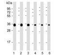 Western blot testing of 1) human HeLa, 2) human Jurkat, 3) human A549, 4) rat C6, 5) mouse NIH 3T3 and 6) mouse brain lysate with GAPDH antibody. Predicted molecular weight ~36 kDa.