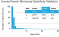 Analysis of HuProt(TM) microarray containing more than 19,000 full-length human proteins using BRCA-1 antibody (clone BRCA1/2973). These results demonstrate the foremost specificity of the BRCA1/2973 mAb. Z- and S- Score: The Z-score represents the strength of a signal that a monoclonal antibody (clone MAb) (in combination with a fluorescently-tagged anti-IgG secondary antibody) produces when binding to a particular protein on the HuProt(TM) array.