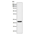 Western blot testing of human HeLa cell lysate with TCTP antibody. Predicted molecular weight ~20 kDa.