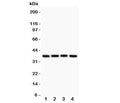 Western blot testing of MCL1 antibody and Lane 1: rat spleen; 2: human HEPG2; 3: (h) MCF-7; 4: (h) COLO320. Predicted molecular weight ~37kDa.