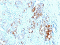 IHC testing of FFPE human prostate with FTL antibody. HIER: boil tissue sections in 10mM citrate buffer, pH 6, for 10-20 min and allow to cool before testing.