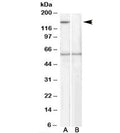 Western blot testing of human EBV-immortilized lymphoblastoid lysate with SIPA1 antibody at 1ug/ml, with (B) and without (A) immunizing peptide. Predicted molecular weight: ~112kDa but routinely observed at ~130kDa. It is observed here at ~150kDa.