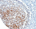 IHC staining of FFPE human tonsil tissue with CD35 antibody (clone CR1/6378) at 2ug/ml. HIER: boil tissue sections in pH 9 10mM Tris with 1mM EDTA for 20 min and allow to cool before testing.