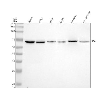 Western blot analysis of SCAI using anti-SCAI antibody. Electrophoresis was performed on a 10% SDS-PAGE gel at 80V (Stacking gel) / 120V (Resolving gel) for 2 hours. Lane 1: human Jurkat whole cell lysates, Lane 2: human K562 whole cell lysates, Lane 3: human U20S whole cell lysates, Lane 4: human U251 whole cell lysates, Lane 5: rat brain tissue lysates, Lane 6: mouse brain tissue lysates. After electrophoresis, proteins were transferred to a nitrocellulose membrane at 150 mA for 50-90 min.