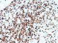 IHC staining of FFPE human tonsil with recombinant TOP2A antibody. HIER: boil tissue sections in pH 9 10mM Tris with 1mM EDTA for 20 min and allow to cool before testing.