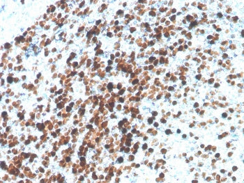 IHC staining of FFPE human tonsil with recombinant TOP2A antibody. HIER: boil tissue sections in pH 9 10mM Tris with 1mM EDTA for 20 min and allow to cool before testing.