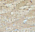 Immunohistochemical staining of FFPE human skeletal muscle tissue with ACSS2 antibody, HRP-secondary and DAB substrate. HIER: boil tissue sections in pH8 EDTA for 20 min and allow to cool before testing.