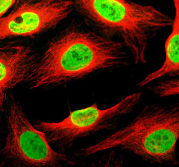 Immunofluorescent staining of THYN1 using anti-THYN1 antibody (green) and anti-Alpha Tubulin antibody (red). THYN1 was detected in an immunocytochemical section of U2OS cells. Enzyme antigen retrieval was performed using IHC enzyme antigen retrieval reagent for 15 mins. The cells were blocked with 10% goat serum. And then incubated with 5 ug/ml rabbit anti-THYN1 antibody and mouse anti-Beta Tubulin antibody overnight at 4oC.