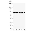 Western blot testing of RelB antibody and Lane 1: rat testis; 2: (h) HeLa; 3: (m) NIH3T3; 4: (h) Raji; 5: (m) HEPA cell lysate. Predicted size: 62-70KD