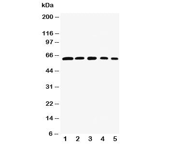 Western blot testing of RelB antibody and Lane 1: rat testis; 2: (h) HeLa; 3: (m) NIH3T3; 4: (h) Raji; 5: (m) HEPA cell lysate. Predicted size: 62-70KD