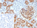 IHC staining of FFPE human prostate tissue with recombinant MME antibody (clone rMME/9377). Inset: PBS used in place of primary Ab (secondary Ab negative control). HIER: boil tissue sections in pH 9 10mM Tris with 1mM EDTA for 20 min and allow to cool before testing.