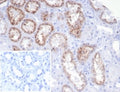 IHC staining of FFPE human kidney tissue with recombinant RBP4 antibody (clone rRBP4/7372). Negative control inset: PBS instead of primary antibody to control for secondary binding. HIER: boil tissue sections in pH 9 10mM Tris with 1mM EDTA for 20 min and allow to cool before testing.