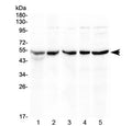 Western blot testing of 1) rat thymus, 2) mouse thymus, 3) mouse spleen, 4) human COLO320 and 5) human HeLa lysate with EIF3e antibody at 0.5ug/ml. Expected molecular weight: 48-52 kDa.