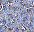 IHC staining of FFPE mouse kidney tissue with Annexin V antibody, HRP-labeled secondary and DAB substrate. HIER: boil tissue sections in pH8 EDTA for 20 min and allow to cool before testing.