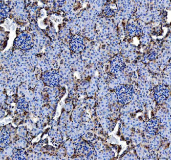 IHC staining of FFPE mouse kidney tissue with Annexin V antibody, HRP-labeled secondary and DAB substrate. HIER: boil tissue sections in pH8 EDTA for 20 min and allow to cool before testing.