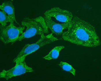 Immunofluorescent staining of FOXI1 using anti-FOXI1 antibody (green). FOXI1 was detected in immunocytochemical section of U20S cells. Enzyme antigen retrieval was performed using IHC enzyme antigen retrieval reagent for 15 mins. The cells were blocked with 10% goat serum. And then incubated with 2ug/ml rabbit anti-FOXI1 antibody overnight at 4oC. DyLight 488 conjugated Goat Anti-Rabbit IgG was used as secondary antibody at 1:100 dilution and incubated for 30 minutes at 37oC. The section was counterstained