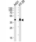 Western blot analysis of lysate from A431, HT-29 cell line (left to right) using Ep-CAM antibody diluted at 1:1000 for each lane. Expected molecular weight: ~35 kDa (unmodified), 40-43 kDa (glycosylated).
