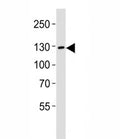 Western blot analysis of lysate from LNCaP cell line using JAK2 antibody diluted at 1:1000. Predicted molecular weight ~130 kDa