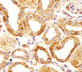 IHC testing of FFPE human kidney tissue with Hyaluronan synthase 2 antibody. HIER: steam section in pH6 citrate buffer for 20 min and allow to cool prior to staining.