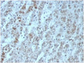 IHC staining of FFPE human adrenal gland tissue with recombinant Interleukin 15 antibody (clone IL15/6971R). HIER: boil tissue sections in pH 9 10mM Tris with 1mM EDTA for 20 min and allow to cool before testing.