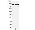 Western blot testing of LRP5 antibody and Lane 1: rat liver; 2: mouse liver; 3: (m) NIH3T3 lysate. Predicted molecular weight ~179 kDa.