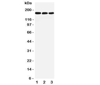 Western blot testing of LRP5 antibody and Lane 1: rat liver; 2: mouse liver; 3: (m) NIH3T3 lysate. Predicted molecular weight ~179 kDa.