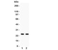 Western blot testing of Rab3A antibody and Lane 1: rat brain; 2: mouse brain lysate
