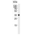 Western blot testing of human skeletal muscle lysate with IFNGR2 antibody. Expected molecular weight: 37-55 kDa.