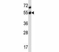 Akt2 antibody western blot analysis in MCF-7 lysate. Predicted molecular weight: ~56kDa.