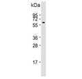 Western blot testing of human kidney lysate with PI4K2A antibody. Predicted molecular weight ~54 kDa.