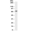 Western blot testing of rat brain lysate with PAK1 antibody at 1ug/ml. Expected molecular weight 60~70 kDa.