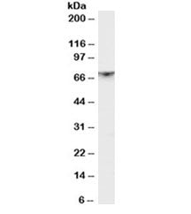 Western blot testing of rat brain lysate with PAK1 antibody at 1ug/ml. Expected molecular weight 60~70 kDa.