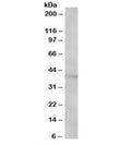 Western blot testing of Jurkat lysate with SAE1 antibody at 1ug/ml. Predicted/observed molecular weight: ~40kDa.