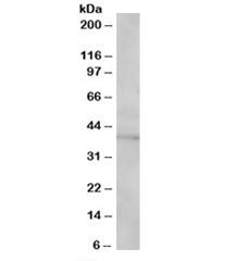 Western blot testing of Jurkat lysate with SAE1 antibody at 1ug/ml. Predicted/observed molecular weight: ~40kDa.