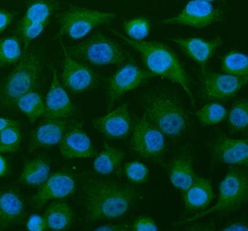 Immunofluorescent staining of MEIOB using anti-MEIOB antibody (green). MEIOB was detected in an immunocytochemical section of cells. Enzyme antigen retrieval was performed using IHC enzyme antigen retrieval reagent for 15 mins. The cells were blocked with 10% goat serum. And then incubated with 5 ug/ml rabbit anti-MEIOB antibody overnight at 4oC. DyLight 488 Conjugated Goat Anti-Rabbit IgG was used as secondary antibody at 1:500 dilution and incubated for 30 min at 37oC.