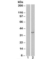 Western blot testing of HEK293 cell lysate overexpressing DOK5 with DOK5 antibody [mock transfection in lane 1]. Predicted molecular weight: ~36kDa.