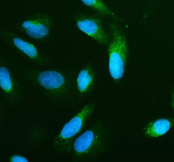 Immunofluorescent staining of BNIP3L using anti-BNIP3L antibody (green). BNIP3L was detected in an immunocytochemical section of U2OS cells. Enzyme antigen retrieval was performed using IHC enzyme antigen retrieval reagent for 15 mins. The cells were blocked with 10% goat serum. And then incubated with 5 ug/ml rabbit anti-BNIP3L antibody overnight at 4oC. DyLight 488 Conjugated Goat Anti-Rabbit IgG was used as secondary antibody at 1:500 dilution and incubated for 30 min at 37oC.