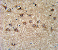 IHC testing of FFPE human brain tissue with Mitoferrin-1 antibody. HIER: steam section in pH6 citrate buffer for 20 min and allow to cool prior to staining.