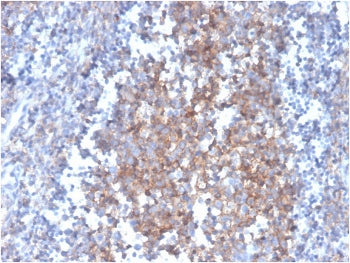 IHC staining of FFPE human tonsil with Fas Ligand antibody (clone FASLG/4455). HIER: boil tissue sections in pH 9 10mM Tris with 1mM EDTA for 20 min and allow to cool before testing.