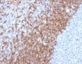 IHC staining of FFPE human tonsil tissue with IgD antibody (clone IGHD/2730R). HIER: boil tissue sections in pH 9 10mM Tris with 1mM EDTA for 20 min and allow to cool before testing.