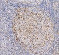 IHC staining of FFPE human tonsil tissue with PD1 antibody. HIER: boil tissue sections in pH8 EDTA for 20 min and allow to cool before testing.