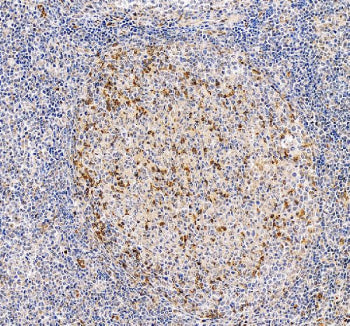 IHC staining of FFPE human tonsil tissue with PD1 antibody. HIER: boil tissue sections in pH8 EDTA for 20 min and allow to cool before testing.