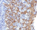 IHC testing of FFPE human prostate with Keratin 14 antibody (clone CTKN14-1). Staining of formalin-fixed tissues requires boiling tissue sections in pH 9 10mM Tris with 1mM EDTA for 10-20 min. followed by cooling at RT for 20 min.