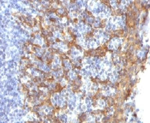 IHC testing of FFPE human prostate with Keratin 14 antibody (clone CTKN14-1). Staining of formalin-fixed tissues requires boiling tissue sections in pH 9 10mM Tris with 1mM EDTA for 10-20 min. followed by cooling at RT for 20 min.