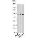 Western blot testing of human samples with HSP60 antibody at 1ug/ml.