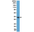 Western blot testing of Raji cell lysate with recombinant CD79a antibody at 1:200 dilution. Expected molecular weight: 25-47 kDa depending on glycosylation level.